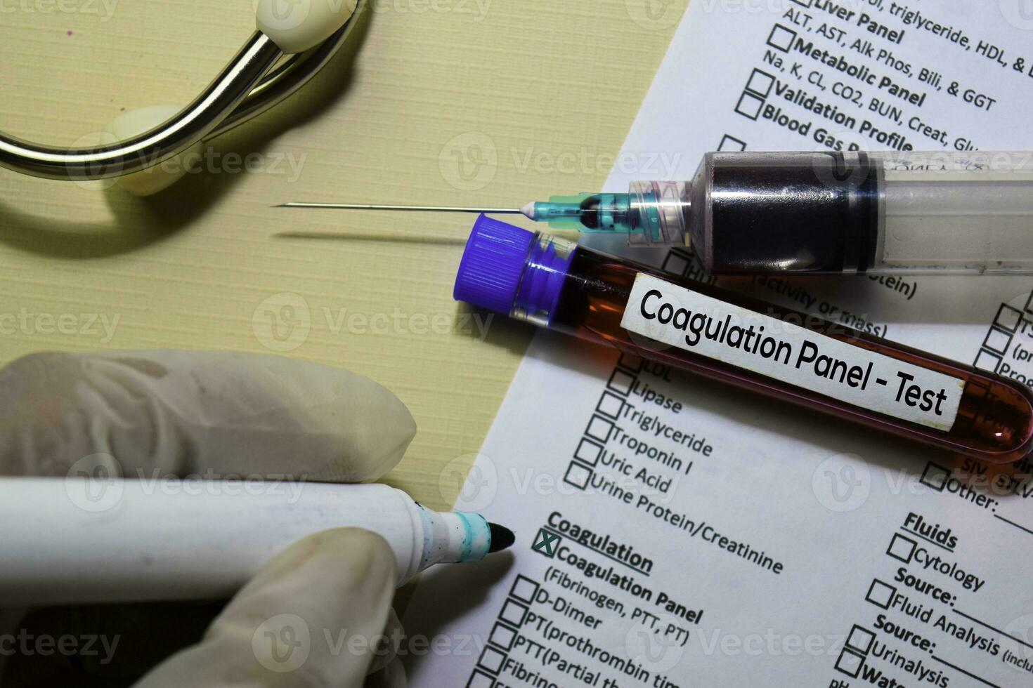 Coagulation Profile